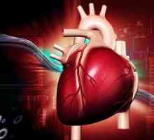 Preparate cardiace: grupuri de bază