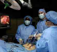 Chirurgie ușoară - laparoscopie