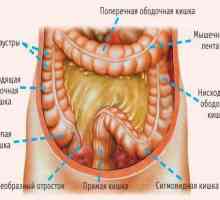 Sigmoidita: simptome, tratament, dietă. Sigmoid colon: unde este și cum doare