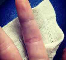 Accidentare severă a degetului: tratament la domiciliu