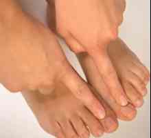 Simptome ale ciupercilor pe picioare, caracteristici și soiuri