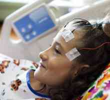 Симптомы эпилепсии у ребенка. Причины, диагностика, лечение