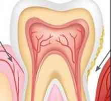 Simptomele parodontitei, diagnosticului și tratamentului