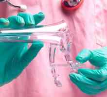 Simptomele cancerului de col uterin: etape, revizuiri privind metodele de tratament