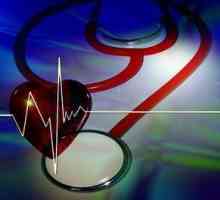 Sindromul hipertensiunii arteriale: cauze, simptome, diagnostic și tratament