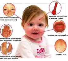 Sindromul Kawasaki la copii: cauze și tratament