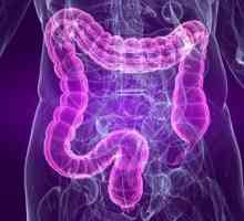Sindromul intestinului iritabil: simptome, tratament