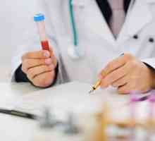 Cât de mult conține drogul în sângele tău? Test de sânge
