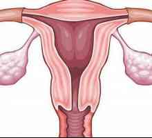 Spasme în uter: cauze posibile, descriere și caracteristici ale tratamentului