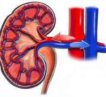 Stenoza arterei renale: cauze posibile, simptome și caracteristici ale tratamentului