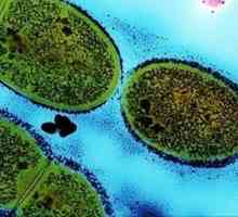 Streptococcus - ce este? Tipuri de streptococi