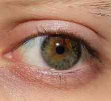 Ochii uscați: cauze și remedii folclorice și picături