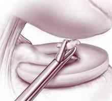Articulat șoarece articulație genunchi: tratament, îndepărtare