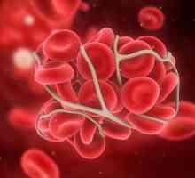 Sisteme de coagulare sanguină și anticoagulare