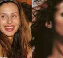 Svetlana Loboda: înainte și după plastic, fotografie