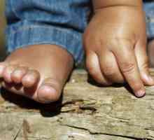 Erupția pe palmele și tălpile copilului: cauze posibile și caracteristici ale tratamentului