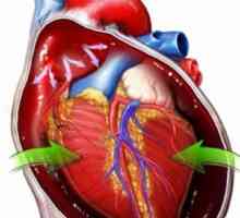Tamponada cardiacă: cauze, simptome, îngrijire de urgență și opțiuni de tratament