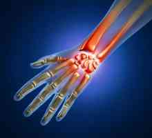 Tendovaginita articulației încheieturilor mâinii: tratament, cauze