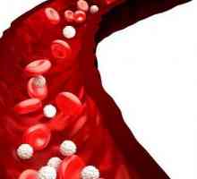 Tipuri de sângerare: cauze, simptome și tratament. Tipuri de sângerare în Barkagan