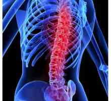 Leziuni la nivelul coloanei vertebrale: clasificare, simptome, tratament