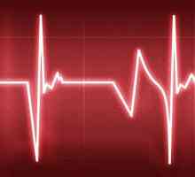 Instruirea inimii și a vaselor de sânge. Complex de exerciții și recomandări ale profesioniștilor