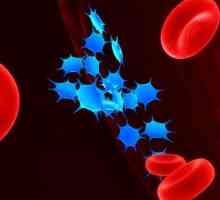 Trombocitopenie - ce este? Cauzele și simptomele bolii