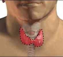 Înlăturarea tiroidei: consecințele intervenției chirurgicale