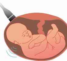Studiu de screening cu ultrasunete. Test de screening pentru sarcină