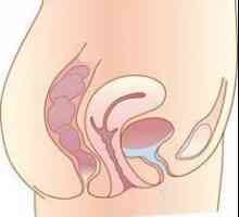 Uretra este ce? Diferențe în structura uretrei la bărbați și femei, simptome și boli