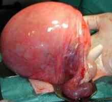 Mărirea uterului: cauze și semne principale