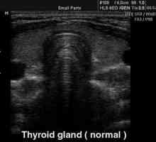 Ecografia glandei tiroide este normală. Mărimea glandei tiroide este normală. Indicatori ai…