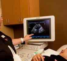 Screening-ul cu ultrasunete de 1 trimestru: interpretarea rezultatelor. Cum se efectuează…