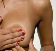 Mastopatia nodulară a sânului: cauze, simptome și tratament
