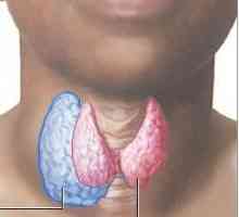 Gusa glanda tiroida: cauze, simptome si metode de tratament