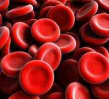 În ce cazuri trebuie să țineți cont de factorul Rh? Sarcina și transfuzia de sânge