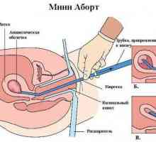 Vacuum întreruperii sarcinii: sincronizare și revizuiri