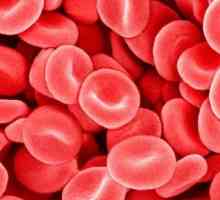 Sunteți îngrijorat de sângele dens: cauzele și tratamentul