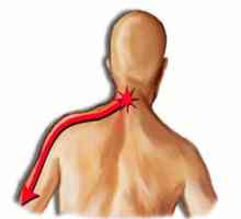 Cervicobrahialgia vertebrogenă: tipuri de manifestări, simptome, diagnostic și tratament
