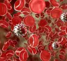 Virus varicella-zoster - ce este? Herpes zoster: tratament, cauze, simptome