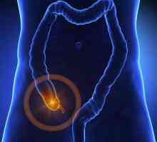 Inflamația apendicitei: o descriere, simptome, cauze și caracteristici ale tratamentului