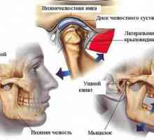 Inflamația articulației maxilare: cauze și tratament