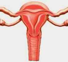 Inflamația ovariană: simptome și tratament la femei, cauze, diagnostic