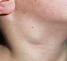 Inflamația ganglionilor limfatici în gât la un copil: cauze și tratament