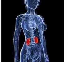 Inflamația rinichiului: simptome la femei. Care sunt simptomele bolii renale la femei?