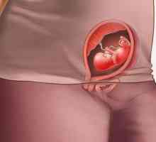 Izolarea galben-verde în timpul sarcinii în perioadele timpurii fără miros - este periculos sau nu?