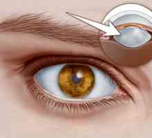 Bolile oculare la om: nume, simptome și tratament, fotografie