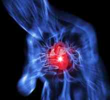 Заболевания сердечно-сосудистой системы человека: симптомы и лечение
