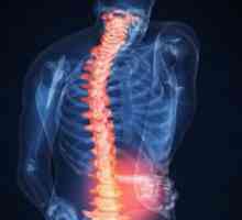 Probleme ale terapiei de exerciții la osteocondroza coloanei vertebrale lombare