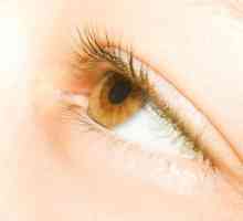 Ochii galbeni la om: cauzele simptomelor ochilor galbeni