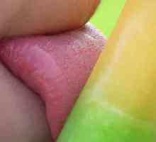 Acoperire galbenă pe limba copilului: tratament, cauze și simptome însoțitoare
